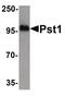 ST8 Alpha-N-Acetyl-Neuraminide Alpha-2,8-Sialyltransferase 4 antibody, PA5-34414, Invitrogen Antibodies, Western Blot image 