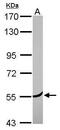 Coronin 2A antibody, PA5-30206, Invitrogen Antibodies, Western Blot image 