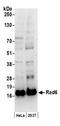 Ubiquitin Conjugating Enzyme E2 A antibody, NB100-554, Novus Biologicals, Western Blot image 