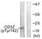CD247 Molecule antibody, LS-C198760, Lifespan Biosciences, Western Blot image 