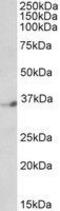 Double PHD Fingers 1 antibody, GTX89872, GeneTex, Western Blot image 