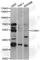 Cyclin A1 antibody, A5631, ABclonal Technology, Western Blot image 