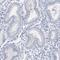 TSPY Like 6 antibody, HPA034699, Atlas Antibodies, Immunohistochemistry paraffin image 