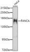 FA Complementation Group A antibody, GTX55613, GeneTex, Western Blot image 