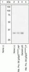 Ribosomal Protein S6 antibody, GTX12865, GeneTex, Western Blot image 