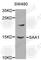 Serum Amyloid A1 antibody, A1655, ABclonal Technology, Western Blot image 