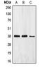 Eukaryotic Translation Initiation Factor 2 Subunit Alpha antibody, LS-C352152, Lifespan Biosciences, Western Blot image 