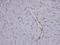 Coronin 1C antibody, NBP1-31283, Novus Biologicals, Immunohistochemistry frozen image 