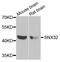 Sorting Nexin 32 antibody, A17611, Boster Biological Technology, Western Blot image 