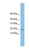 Trafficking Protein Particle Complex 1 antibody, NBP1-57715, Novus Biologicals, Western Blot image 