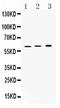 ATPase H+/K+ Transporting Subunit Beta antibody, A08719-1, Boster Biological Technology, Western Blot image 