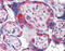 Platelet Derived Growth Factor Receptor Alpha antibody, 51-099, ProSci, Immunohistochemistry paraffin image 