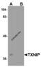 Thioredoxin Interacting Protein antibody, 7941, ProSci, Western Blot image 