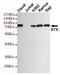 Bruton Tyrosine Kinase antibody, STJ99116, St John