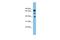 LETM1 Domain Containing 1 antibody, A08013, Boster Biological Technology, Western Blot image 