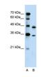 Phosphoribosyl Pyrophosphate Synthetase 2 antibody, orb330182, Biorbyt, Western Blot image 