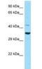 Indoleamine 2,3-Dioxygenase 2 antibody, NBP1-98545, Novus Biologicals, Western Blot image 