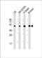 Solute Carrier Family 2 Member 3 antibody, PA5-72331, Invitrogen Antibodies, Western Blot image 