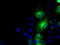 Betaine--Homocysteine S-Methyltransferase antibody, GTX84828, GeneTex, Western Blot image 