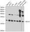 Eukaryotic Translation Initiation Factor 1A Y-Linked antibody, GTX32576, GeneTex, Western Blot image 