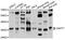 CCR4-NOT Transcription Complex Subunit 7 antibody, STJ111494, St John