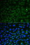 Lysosomal Associated Membrane Protein 1 antibody, STJ113156, St John