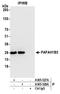 Platelet Activating Factor Acetylhydrolase 1b Catalytic Subunit 3 antibody, A305-528A, Bethyl Labs, Immunoprecipitation image 