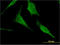 Hexosaminidase Subunit Alpha antibody, LS-C197404, Lifespan Biosciences, Immunofluorescence image 