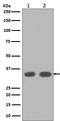 Cyclin D1 antibody, M00149-1, Boster Biological Technology, Western Blot image 