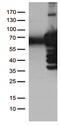 Polo Like Kinase 1 antibody, M00182-1, Boster Biological Technology, Western Blot image 