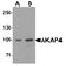 AKAP4 antibody, TA349098, Origene, Western Blot image 