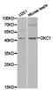 Dyskerin Pseudouridine Synthase 1 antibody, TA327204, Origene, Western Blot image 