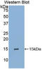 Glycophorin A (MNS Blood Group) antibody, LS-C294297, Lifespan Biosciences, Western Blot image 