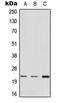 Mediator Complex Subunit 22 antibody, MBS820553, MyBioSource, Western Blot image 