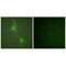 Adducin 1 antibody, A01575, Boster Biological Technology, Immunofluorescence image 