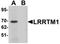 Leucine Rich Repeat Transmembrane Neuronal 1 antibody, orb75561, Biorbyt, Western Blot image 