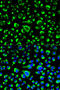 Prolyl 4-Hydroxylase Subunit Beta antibody, STJ24881, St John