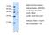 Fumarylacetoacetate Hydrolase antibody, PA5-42050, Invitrogen Antibodies, Western Blot image 