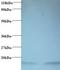 Hemoglobin Subunit Alpha 2 antibody, orb242554, Biorbyt, Western Blot image 