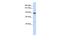 Phosphodiesterase 3B antibody, PA5-42560, Invitrogen Antibodies, Western Blot image 