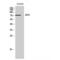 DEAD-Box Helicase 3 X-Linked antibody, LS-C383095, Lifespan Biosciences, Western Blot image 