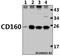 CD160 Molecule antibody, A06168T45, Boster Biological Technology, Western Blot image 