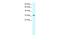 Small Nuclear RNA Activating Complex Polypeptide 2 antibody, A12887, Boster Biological Technology, Western Blot image 