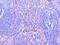 Protein Tyrosine Phosphatase Non-Receptor Type 1 antibody, A00613-1, Boster Biological Technology, Immunohistochemistry paraffin image 