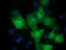 Protein lin-7 homolog B antibody, TA501516, Origene, Immunofluorescence image 