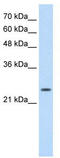 Troponin I1, Slow Skeletal Type antibody, TA346350, Origene, Western Blot image 