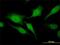 Regulator Of G Protein Signaling 20 antibody, H00008601-M04, Novus Biologicals, Immunocytochemistry image 