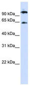 RUNX1 Partner Transcriptional Co-Repressor 1 antibody, TA344444, Origene, Western Blot image 