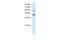 Protein Arginine Methyltransferase 3 antibody, 27-506, ProSci, Western Blot image 