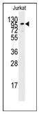 Adenylate Cyclase 2 antibody, AP12381PU-N, Origene, Western Blot image 